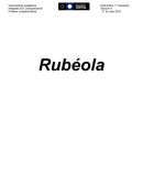 Rubéola.
