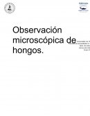 Observación microscópica de hongos.