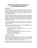 HIPERPLASIA BENIGNA DE PROSTATA Y CARCINOMA DE PROSTATA