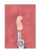 El aborto - Monografia