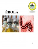 El ébola es una enfermedad poco común y mortal causada por la infección por una de las especies del virus del Ébola y puede causar enfermedades en seres humanos y primates no humanos. El virus Ébola, emergió por primera vez en dos importantes brotes