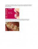 Bases y cementos en odontologia.