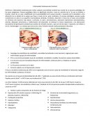 Enfermedad Cardiovascular Cerebral.