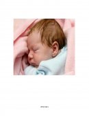 DEGLUCIÓN EN EL SÍNDROME HIPOTÓNICO.