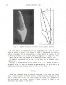 Esponda incisivo central odontologia