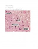 LAS CARACTERISTICAS DEL TEJIDO NERVIOSO