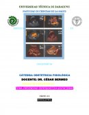 ENFERMEDAD TROFOBLASTICA GESTACIONAL.