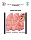 TEMA- ESCUELA SUPERIOR POLITECNICA DE CHIMBORAZO