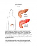 PANCREATITIS AGUDA RESUMEN