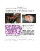 Infecciones sexuales.Sifilis