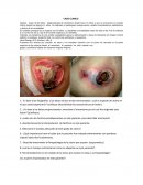 CASO CLINICO. Alzheimer