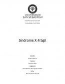 Sindrome X-fragil