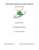 Operatoria dental. Pasos para el recubrimiento pulpar directo