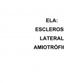La esclerosis lateral amiotrófica fue descrita por primera vez en 1869