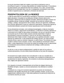 FISIOPATOLOGÍA DE LA RIGIDEZ