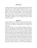 La película “Piratas de Silicon Valley”