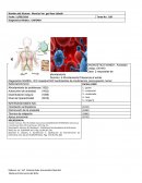 Diagnostico Medico: LINFOMA