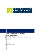 TEORIA DE LA AGUJA HIPODERMICA