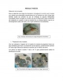 Proyecto (penicilina)