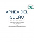 Pae de apnea del sueño