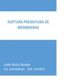 Ensayo de Ruptura prematura de membranas.
