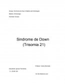 Sindrome de Down (Trisomia 21)