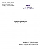 Antecedentes Personales: Lupus Eritematoso Sistemico desde hace 30 años aproximadamente actualmente controlado con Cellcept 500 mg. Hipertension arterial desde hace 10 años paroximadamente, controlado con Losartan Potasico 50 mg.