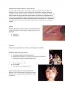Patologías relacionadas al órgano en cuestión de labio