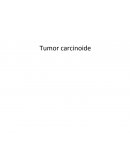 Tumor Carcinoide
