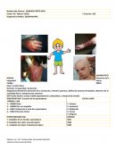 Diagnostico Nanda R/C alteración de la circulación, irritantes químicos, déficit de volumen de líquidos, deterioro de la movilidad física y temperaturas extremas