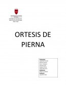 ORTESIS DE PIERNA
