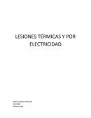 Factores que determinan la gravedad de las lesiones por electricidad