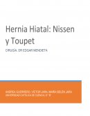Hernia Hiatal Nissen o Toupet