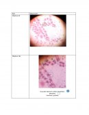 Se observa que la mayoría de células se encuentra en las fase de interface y profase debido a su forma “esférica” y pequeños puntos que alcanzan a ser percibidos a través del microscopio