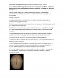 Disostosis cleidocraneana