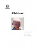Albinisno