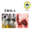 Brotes de la enfermedad del Ébola en el pasado