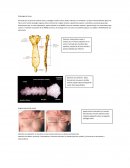 Osteologia de torax y costillas