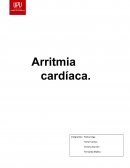 ¿Qué es una Arritmia Cardiaca?