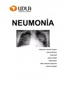 Neumonia. Es fundamental que exista una fisiología pulmonar normal para obtener el requerimiento de oxigeno adecuado
