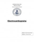 Como Educar al equipo de salud referente al electrocardiograma