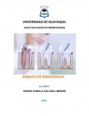 ENSAYO DE ENDODONCIA. PATOLOGÍAS PULPARES Y PERIAPICALES