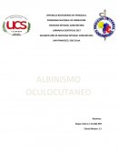 El albinismo oculocutáneo. ¿Qué es?