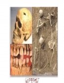 ANTROPOLOGÍA FORENSE “DEBEMOS HACER HABLAR A LOS HUESOS O AL CUERPO”