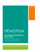La hemofilia es un trastorno hereditario de la coagulación