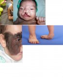 TÓXICOS TERATOGÉNICOS