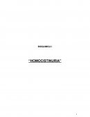 BIOQUIMICA I “HOMOCISTINURIA”