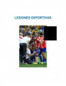 Lesiones deportivas ¿Qué son las lesiones deportivas?
