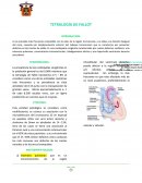 Tetralogia de fallot TETRALOGÍA DE FALLOT