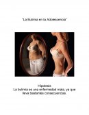 Ensayo “La Bulimia en la Adolescencia”